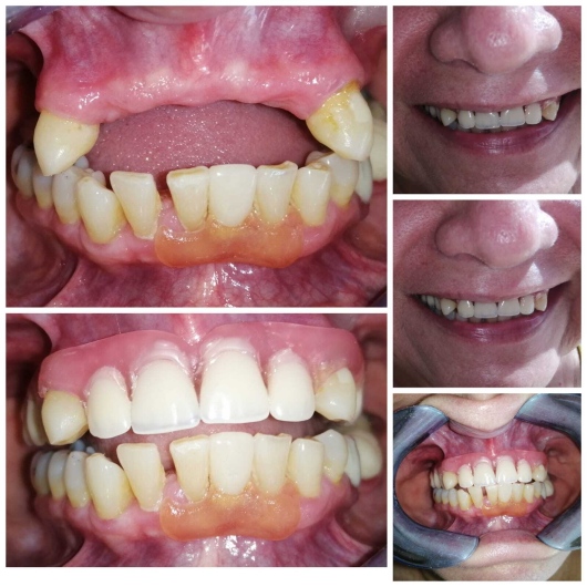 Emma Selenia Hernández Castillo-35