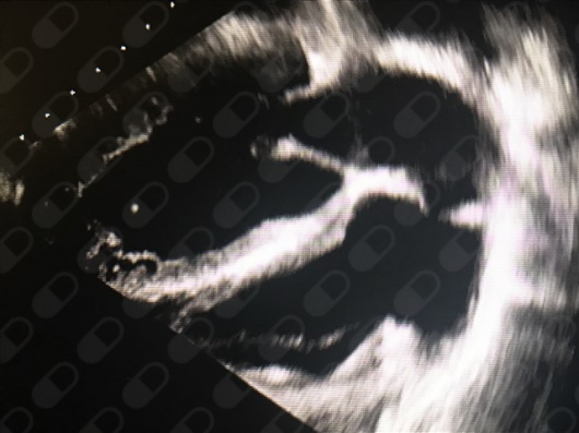 Omar Alejandro Márquez Valero-1