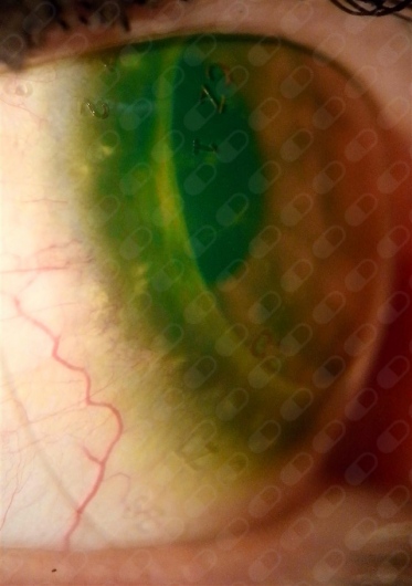 César Enoc Sandoval Pérez-0