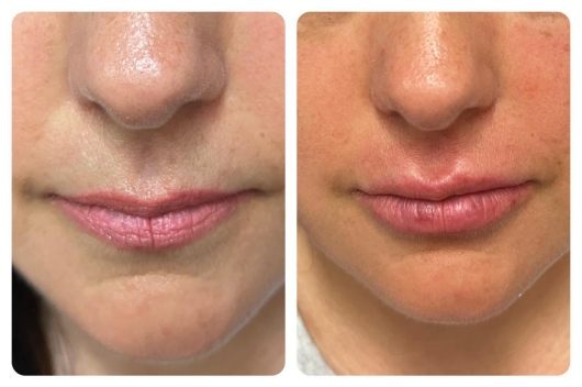 Arturo Romero Grande-10