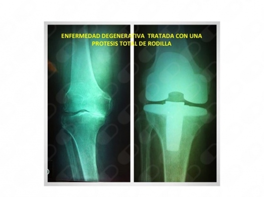 Juan José Díaz Romero-11