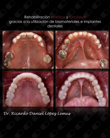 Ricardo López Lemus-86