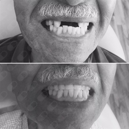 Analí García García-9