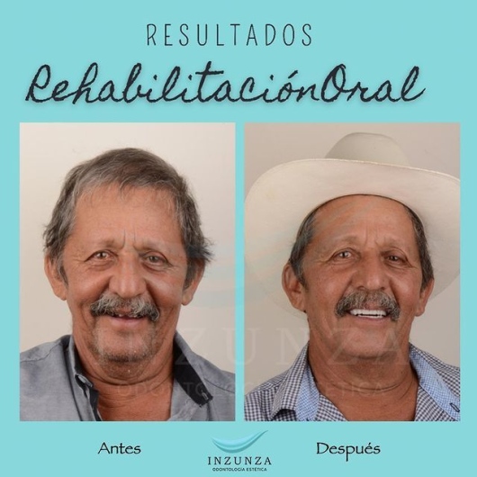 Luis Guillermo Inzunza Castro-30