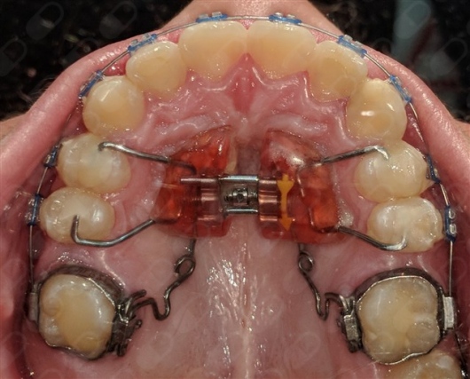 Luis José Aguirre Montiel-8