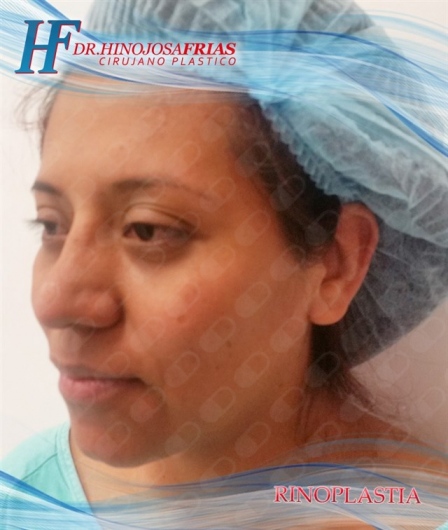 Miguel Ángel Hinojosa Frías-23