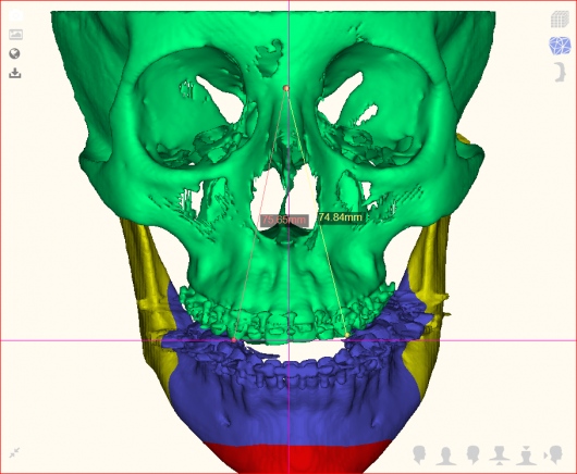 Juan Carlos Romero Alvarado-7