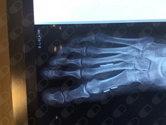 Oscar Suárez Requena-1