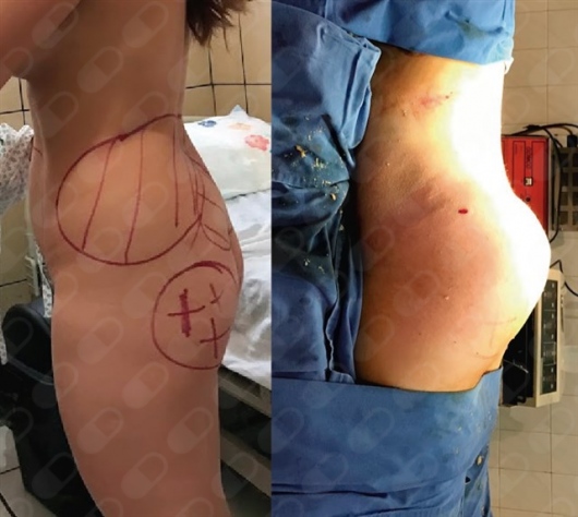 J. Antonio Meré Gómez-15