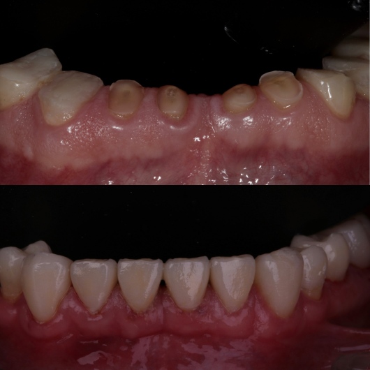 Hugo Moran Negrete-7