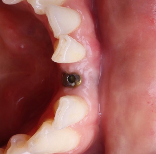 Dilan González Castrejon-13