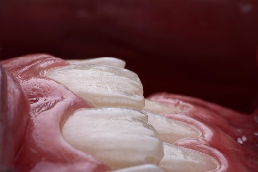 Dilan González Castrejon-20