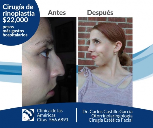 Carlos Castillo Garcia-3