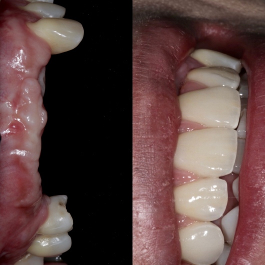 Hugo Moran Negrete-2