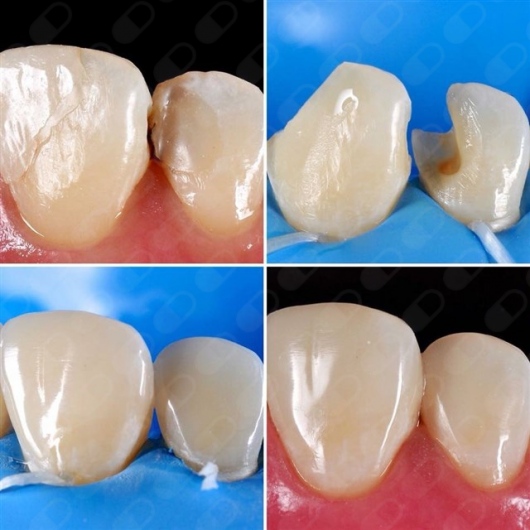 Analí García García-11