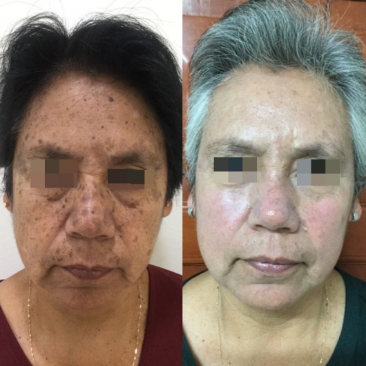 Dafne Arellano Montalvo-10