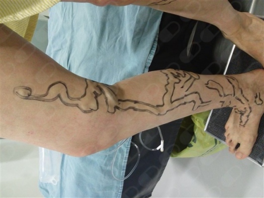 Jesús Montes De Oca Narváez-3