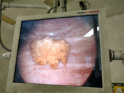 Williams Niño Najera-4