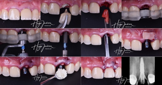 Hugo Juárez César-0