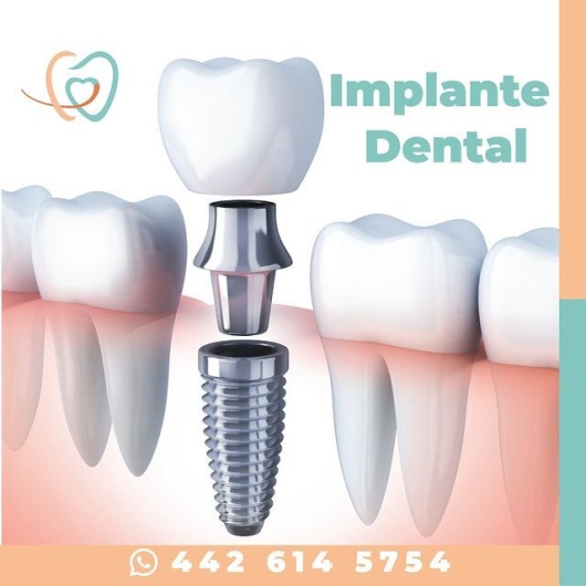 Delia Celestin Navarrete-10