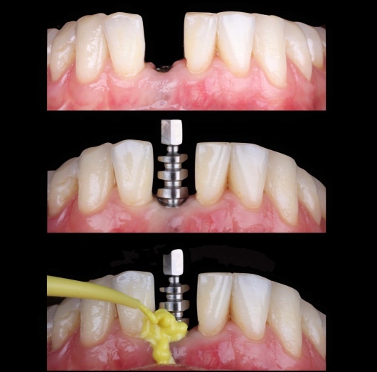 Dilan González Castrejon-12