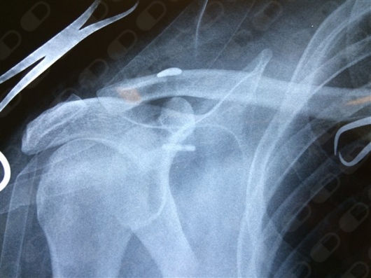 Arturo Reyes Mares-9