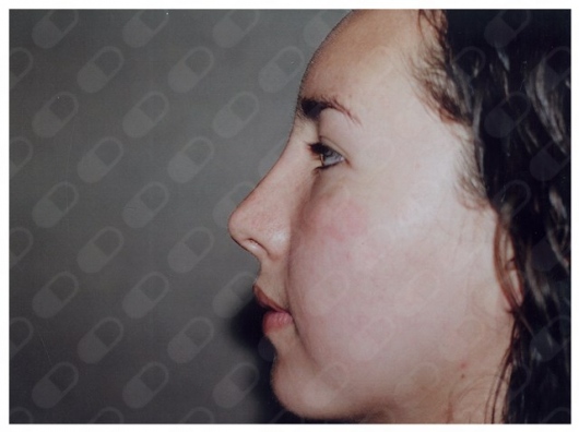 Luis Fernando Sanchez - Medal Alarcón-2