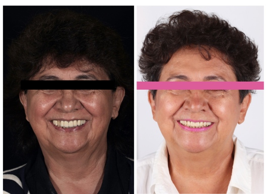 Dilan González Castrejon-18