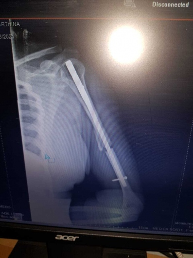 Valerio Licerio De La Cruz-11