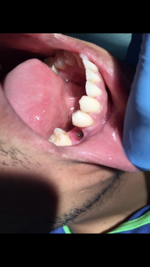 Arturo Romero Grande-27