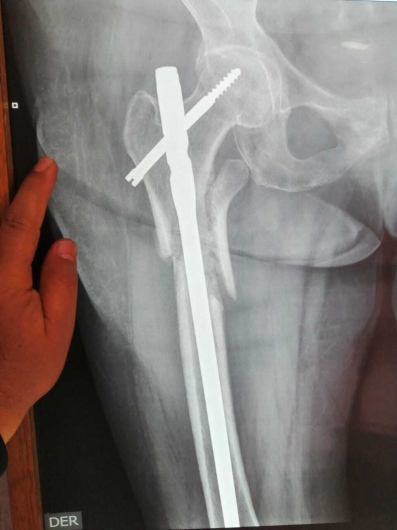 Valerio Licerio De La Cruz-13