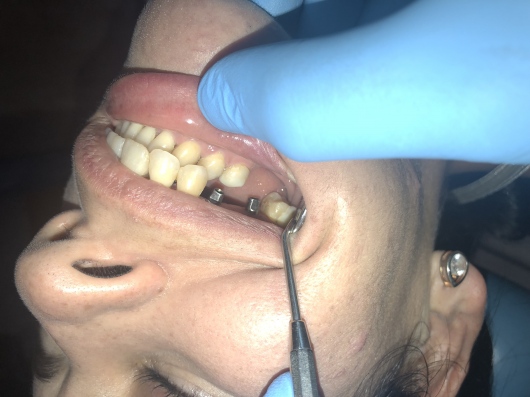 Arturo Romero Grande-40