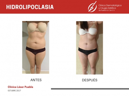 Dafne Arellano Montalvo-31