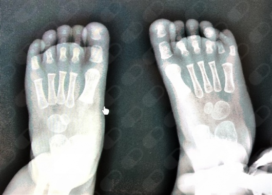 David Rojas Osorio-3