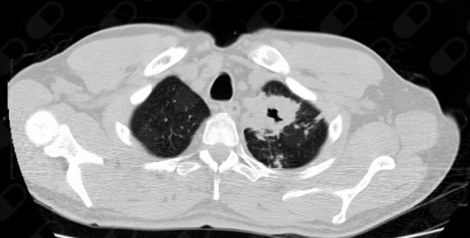 Alejandro Marin Castañeda Baron-14
