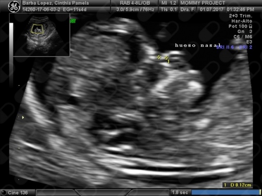 Fabiola Elizabeth Garcia Padilla-33