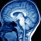 Dr. Néstor Alberto Estrada Venegas