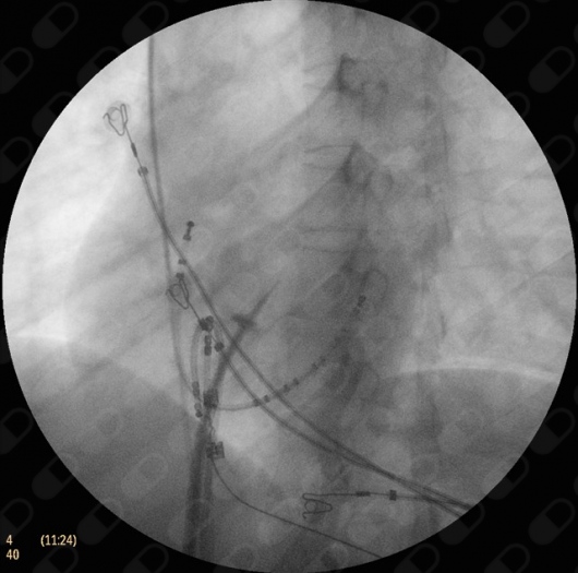 Alex Daniel Pacheco Bouthillier-5