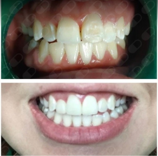 Abel Angel Martínez Partida-7