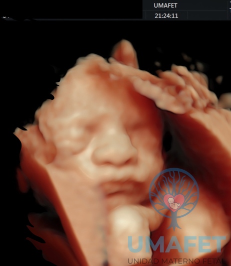 Alejandro Gaspar Vera-0