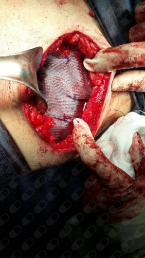 Rosa Maria Carreon Bringas-7