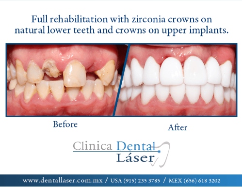 Zonia Edith Barrandey Orozco-11