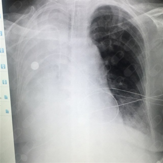 Bertha Lizzeth Gonzalez Cansino-3