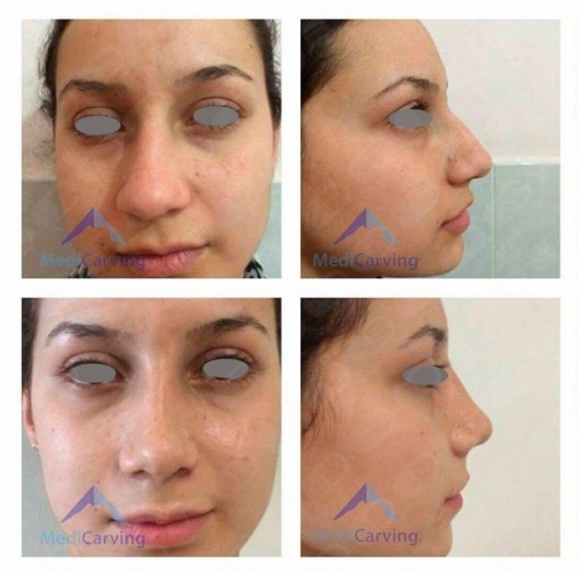 Rafael Velázquez Razo-18