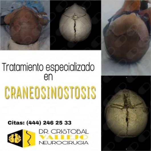 Cristobal Abraham Vallejo Moncada-6