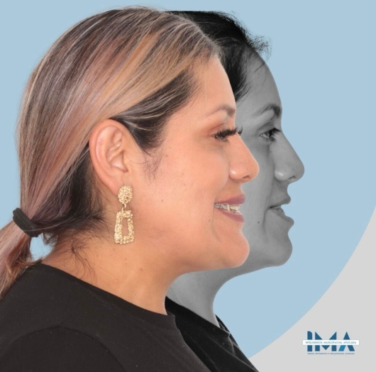 Juan Carlos Romero Alvarado-8