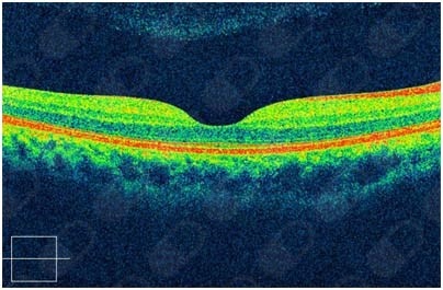 Edgard Rodríguez Torres-4