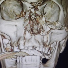 Dr. Ricardo Arturo Torres Hernandez