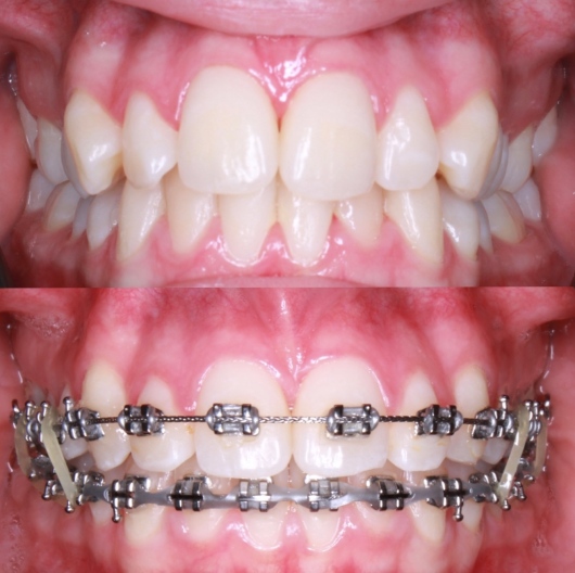 Uriel Alvarado Castillo-3