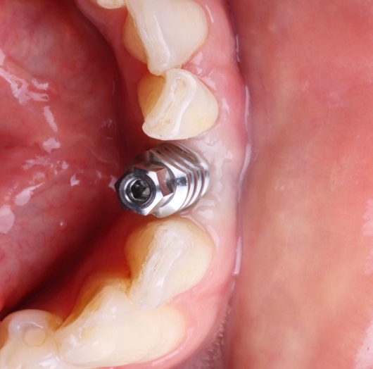 Dilan González Castrejon-23